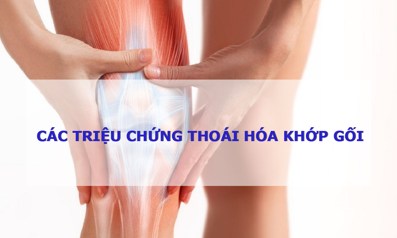 Thoái hóa khớp gối