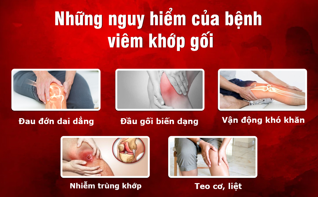 Những nguy hiểm khi bị bệnh thoái hóa khớp gối